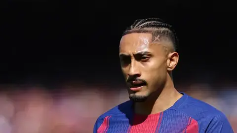 Rafinya məşqdə zədələnmiş formada